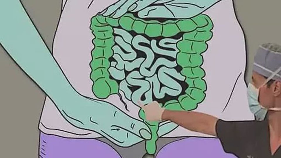 Schema dell'apparato digerente — ricette per una digestione più serena la sera